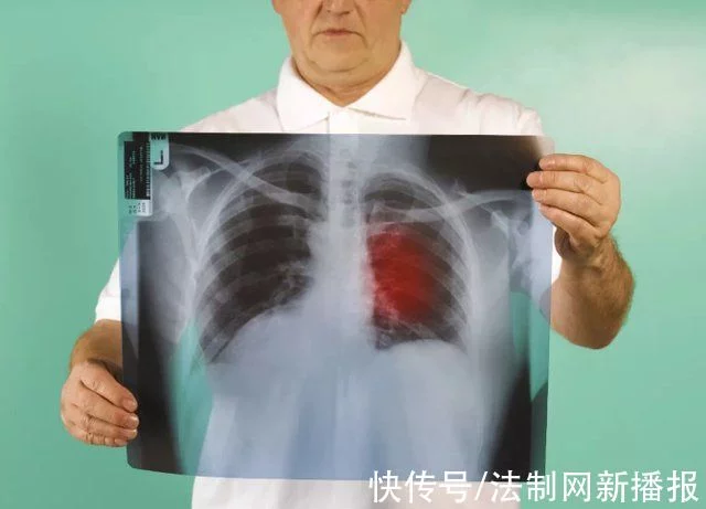 小伙电子烟不离嘴住进医院，医生提醒：电子烟并非香烟安全替代品(图1)
