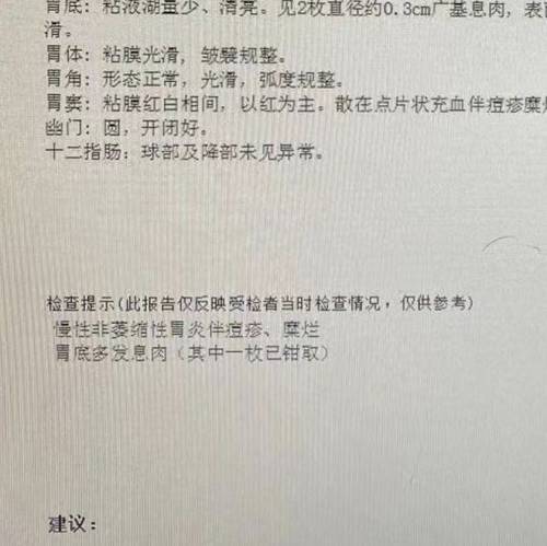 【格物】你看到的“YOOZ假货抽吐血”有可能是假的(图3)