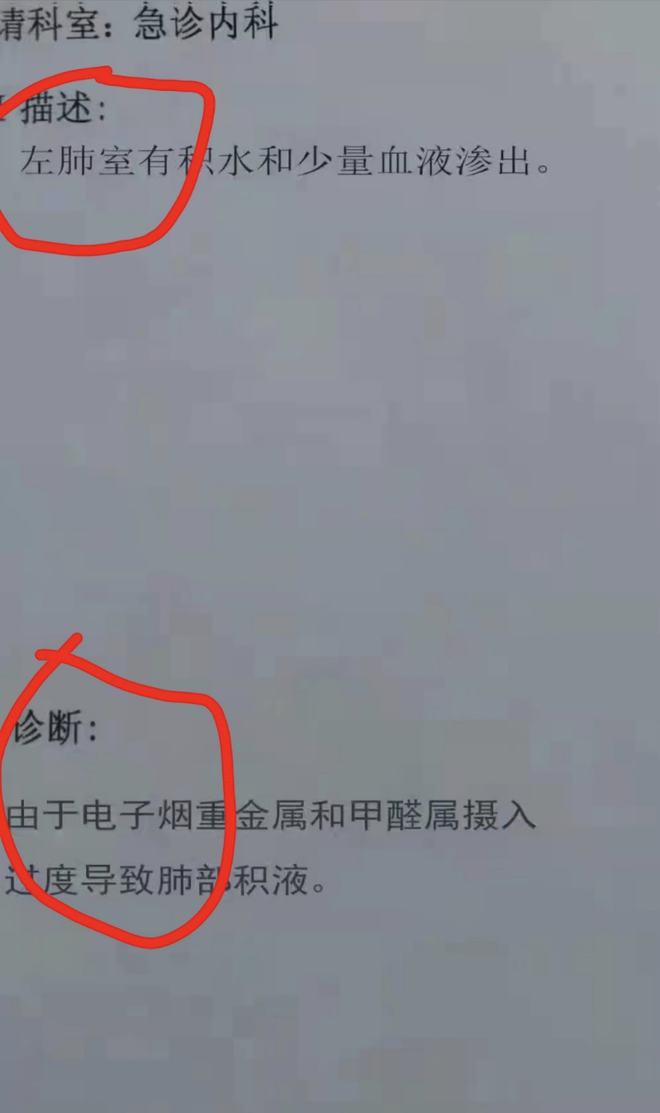 【格物】你看到的“YOOZ假货抽吐血”有可能是假的(图2)