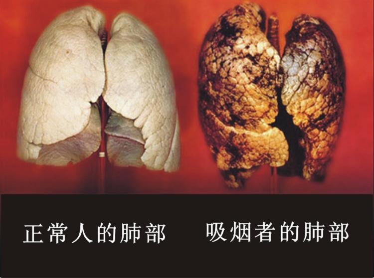 苏州电子烟排行_电子烟和烟谁人危害大_日本电子烟品牌排行