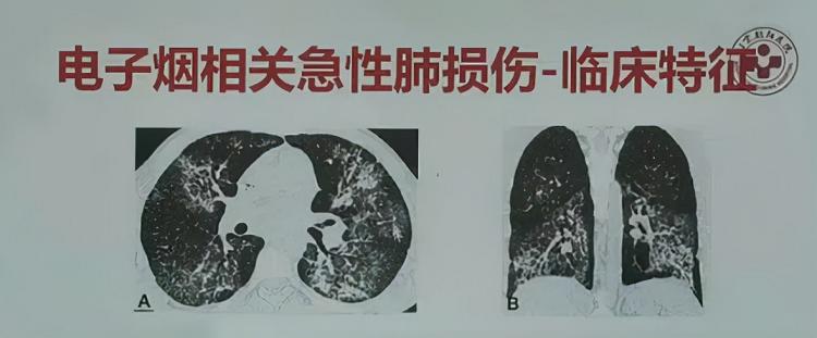 你抽的电子烟,让这个湖南老板身家640亿